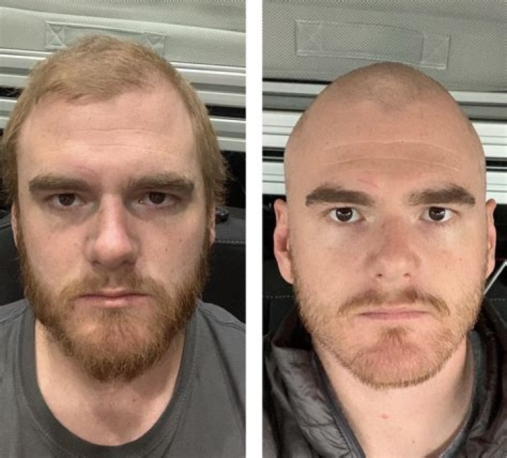 Should I shave off my unibrow?