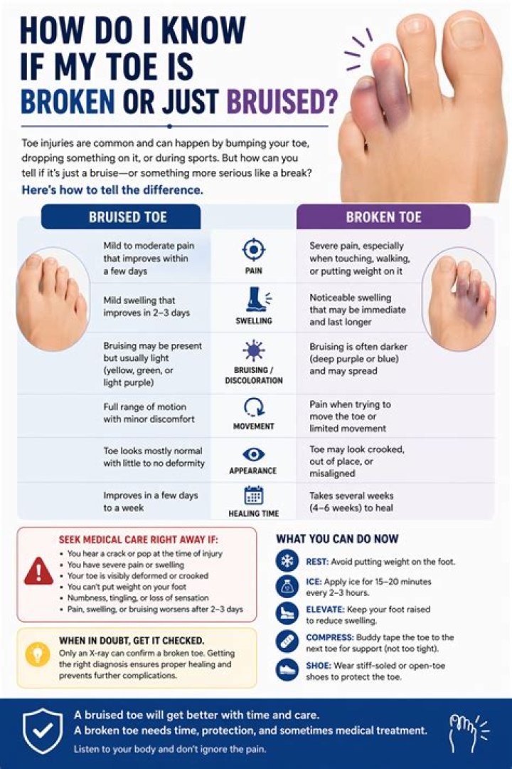 Should I wrap a bruised toe?