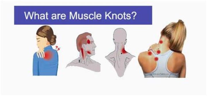Should you massage muscle knots?
