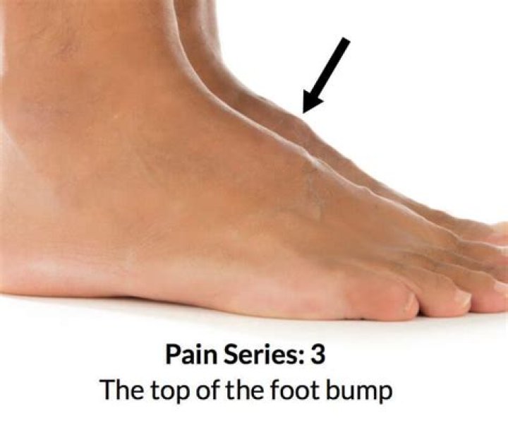 What's the bump on your ankle called?