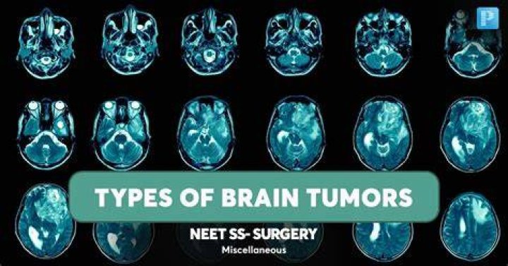 What age gets brain tumors?