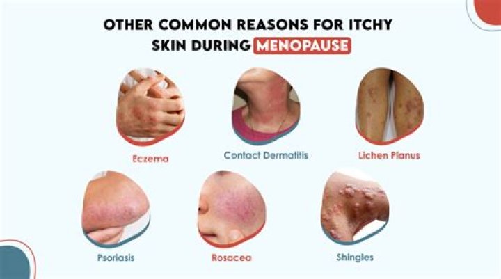 What are itchy arms a symptom of?