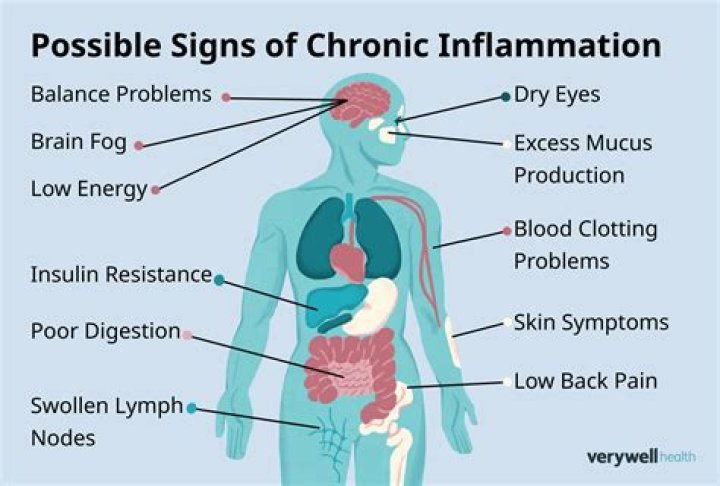 What are the 4 main signs of inflammation?