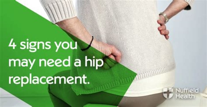 What are the signs of needing a hip replacement?
