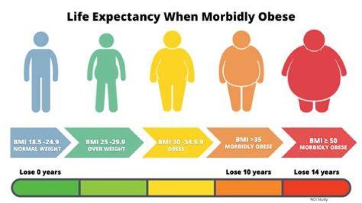 What BMI morbidly obese?