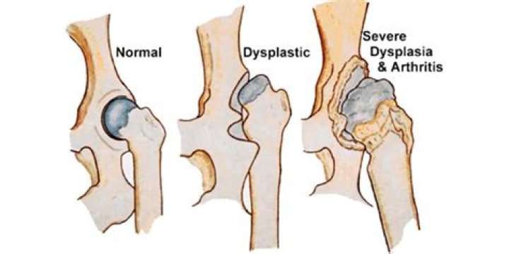 What breeds get hip dysplasia?
