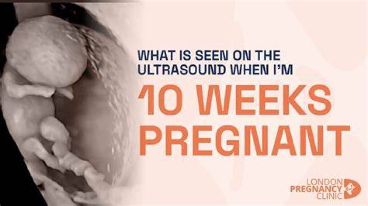 What can I expect at my 10 week ultrasound?