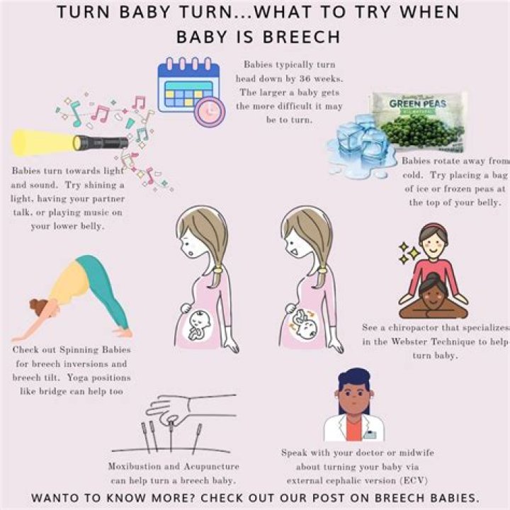 What causes a baby to be born with a mermaid tail?