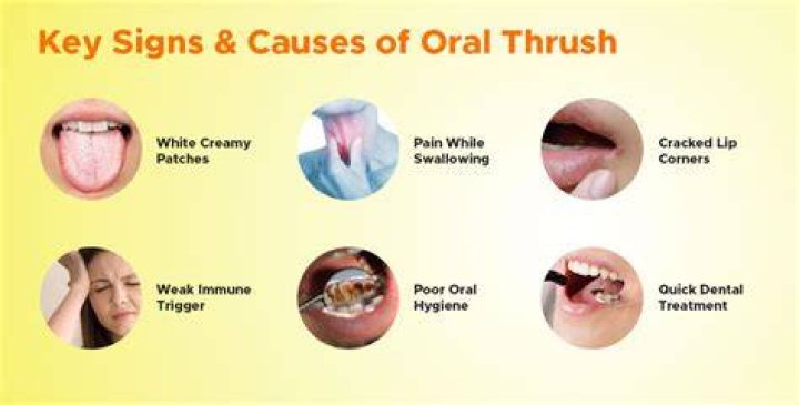 What causes female thrush?