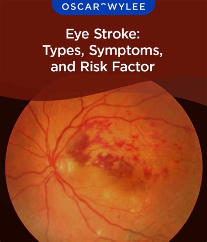 What causes stroke behind eye?