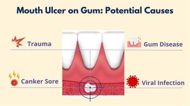 What does Eee gum mean?