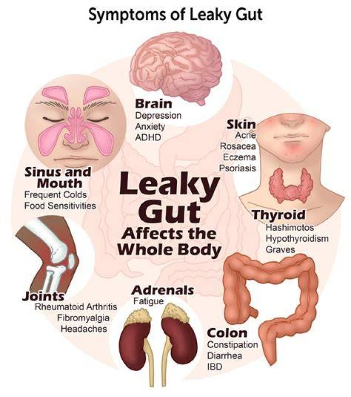 What does leaky gut feel like?