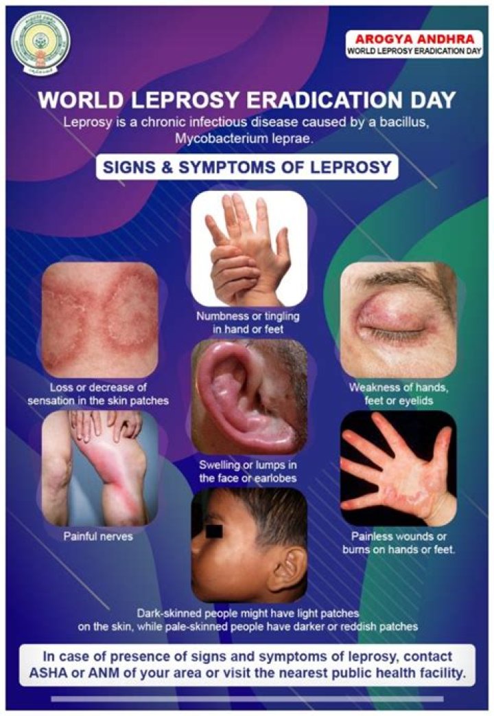 What does leprosy look like?
