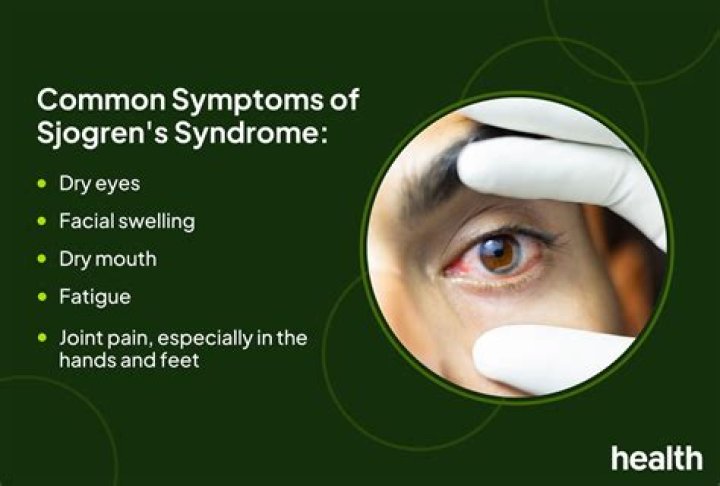 What does Sjogren's fatigue feel like?