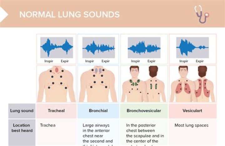 What does wet lungs sound like?