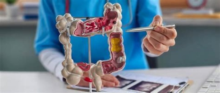 What happens if diverticulitis goes untreated?