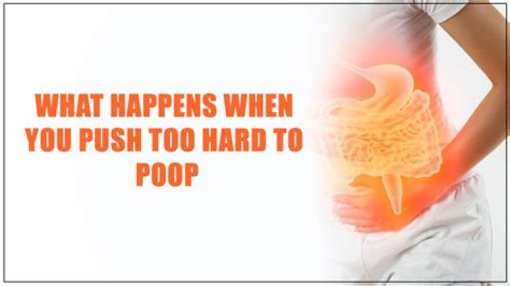 What happens if you push before fully dilated?