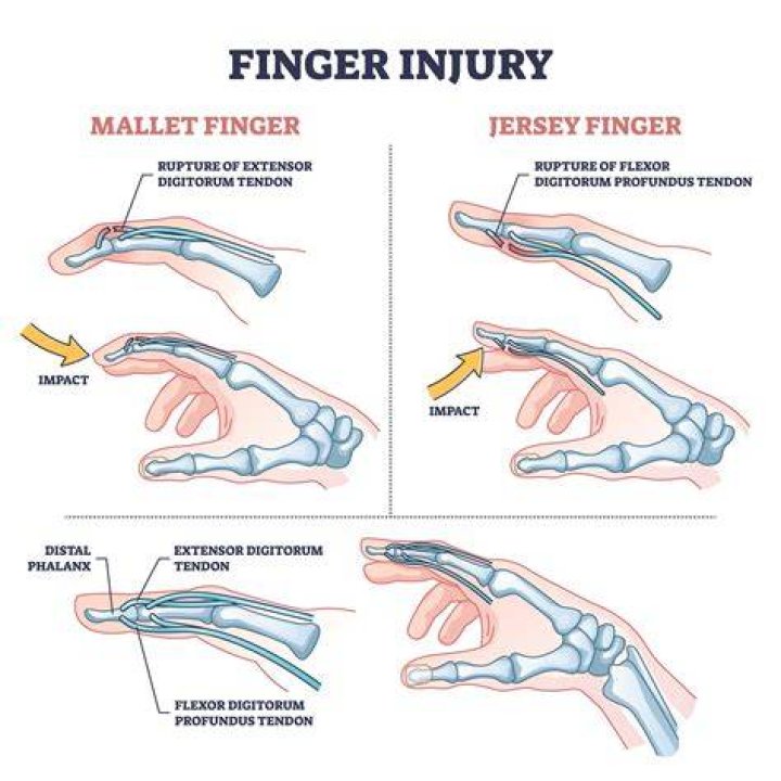 What happens when you cut your finger?