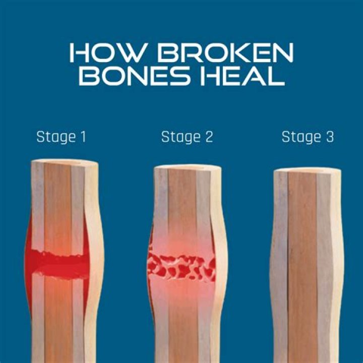 What helps bones heal quickly?