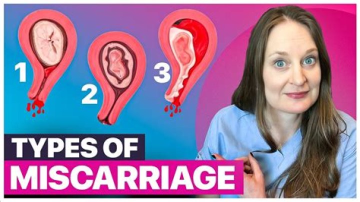 What is a miscarried baby?