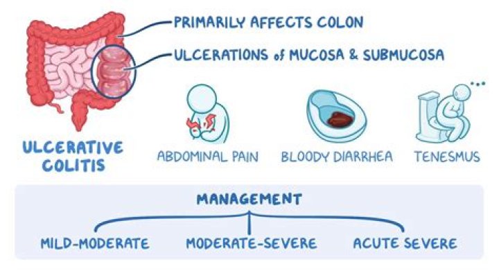 What is acute bloody diarrhea?
