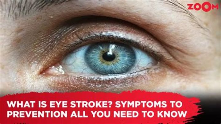 What is an eye stroke?