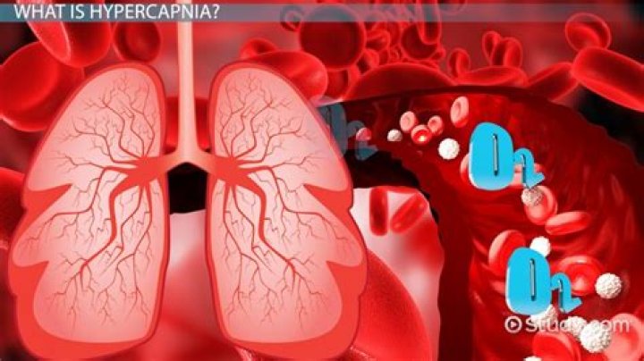 What is hypercapnia?