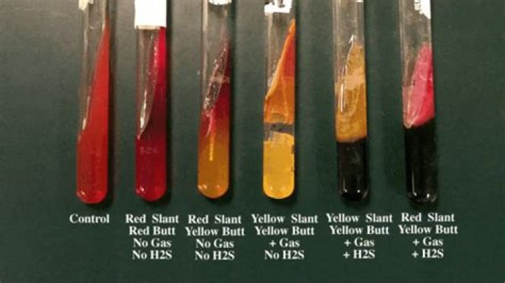 What is on the TSI test?