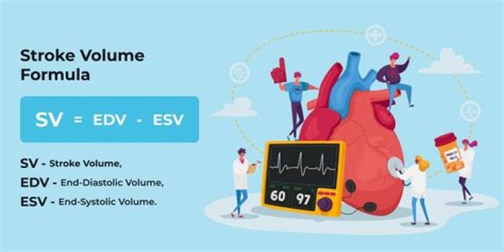 What is stroke formula?