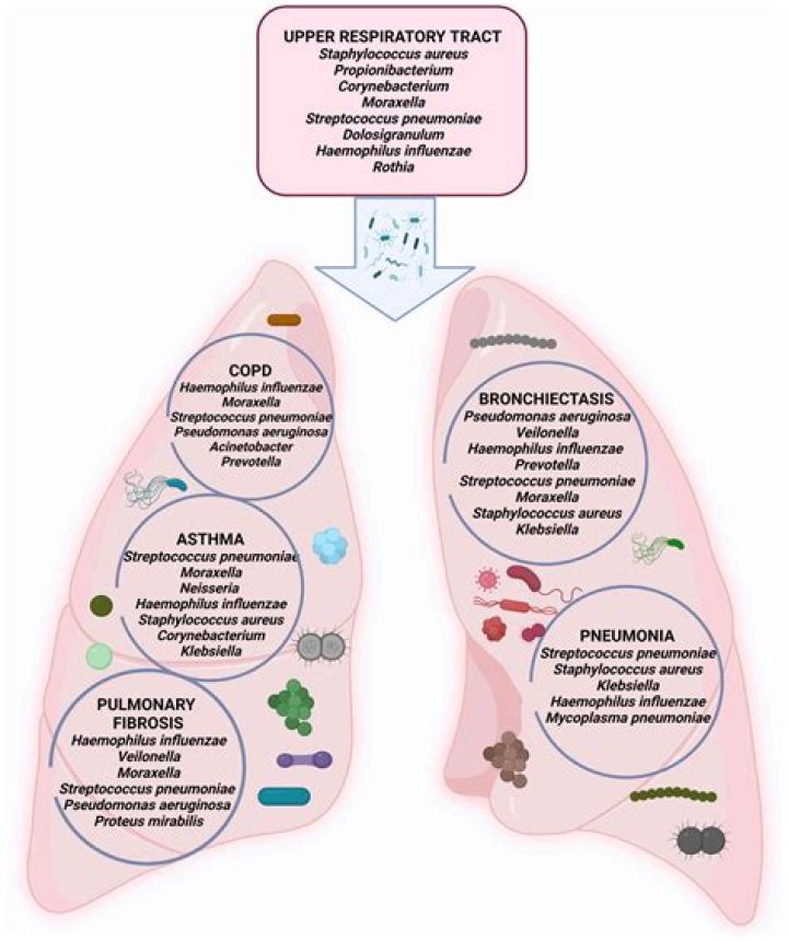 What is the most common lower respiratory tract infection?