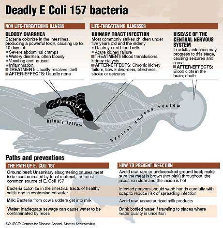 What kills E. coli?