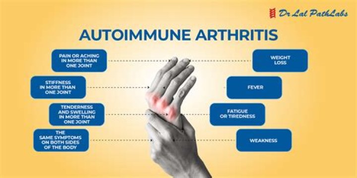 What kind of arthritis is in the hands?