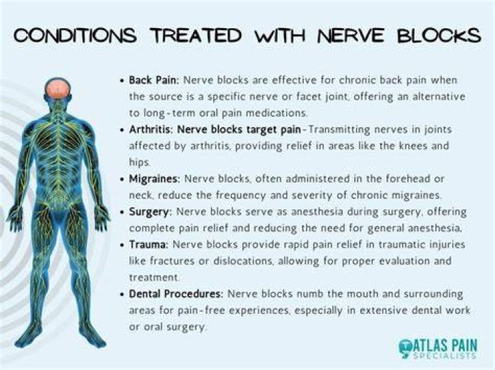 What medications are nerve blockers?