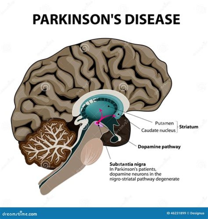 What organs are affected by Parkinson's?