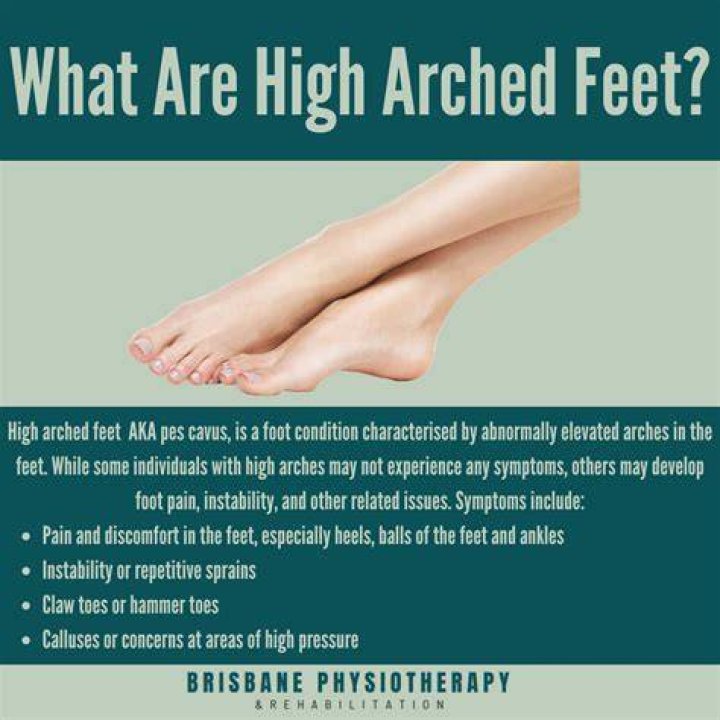 What problems do high arches cause?
