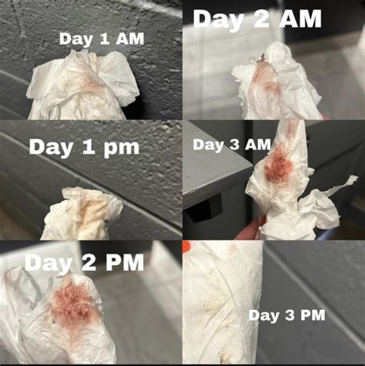 What should I do the day before my MRI?