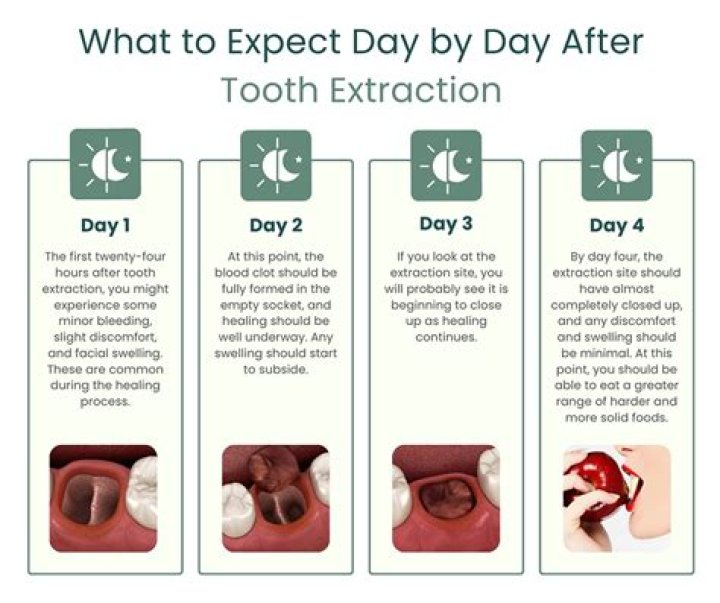 What should tooth extraction look like after 3 days?