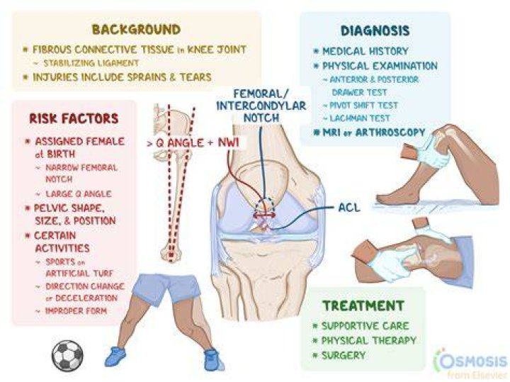 What should you not do with a torn ACL?