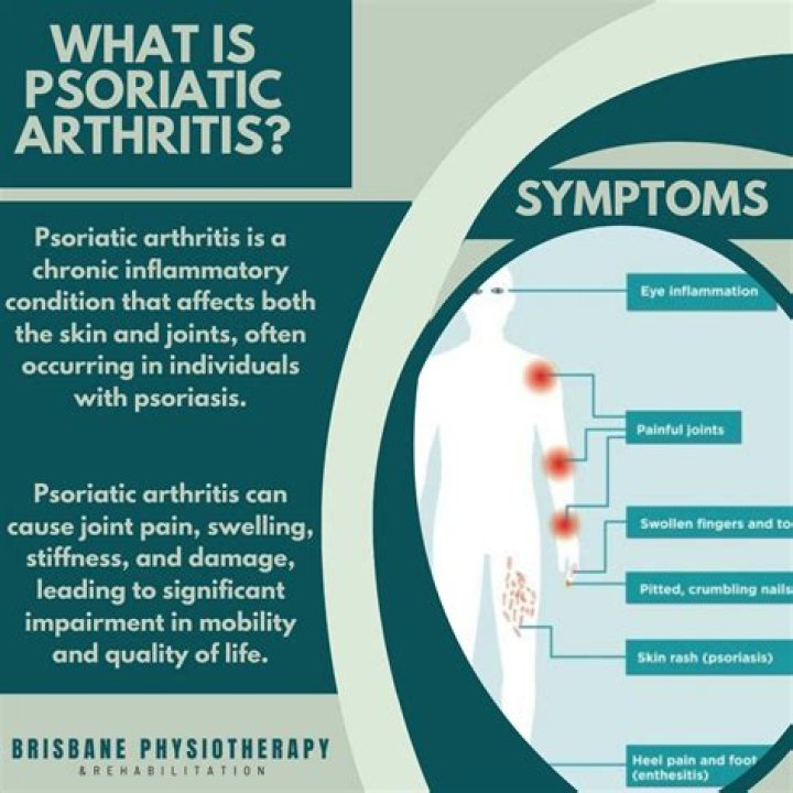 What should you not say to someone with psoriatic arthritis?