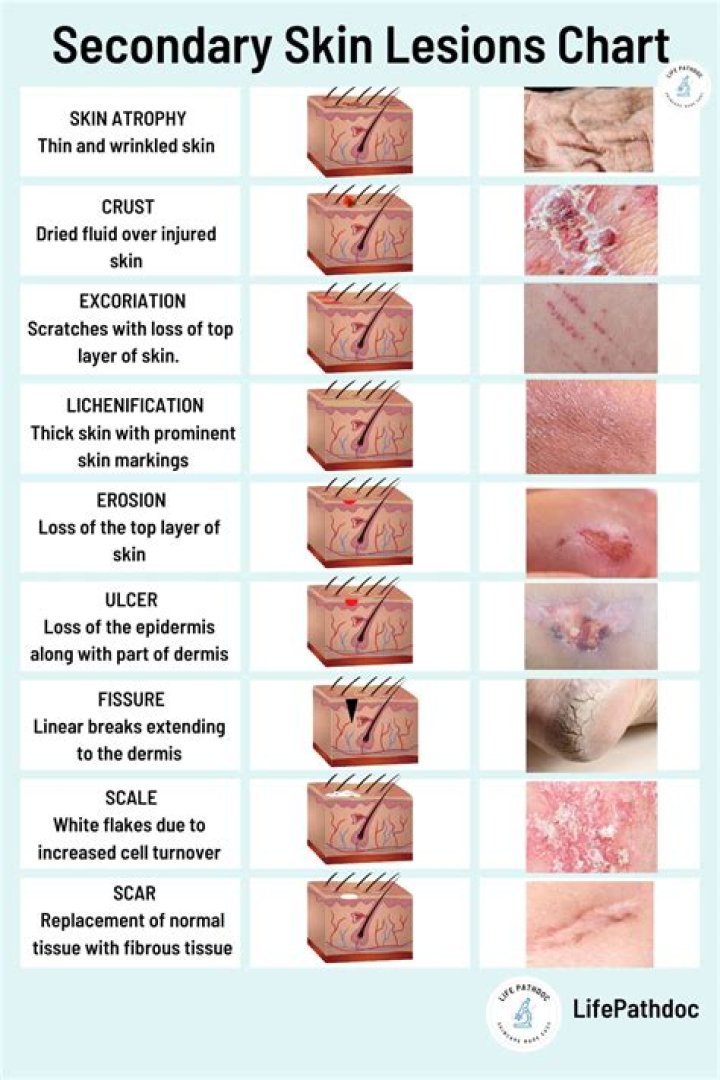 What skin condition is often life-threatening?