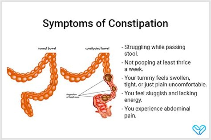 Where do you feel constipation pain?