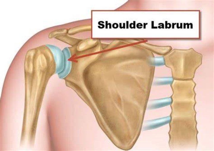 Where does labrum pain hurt?