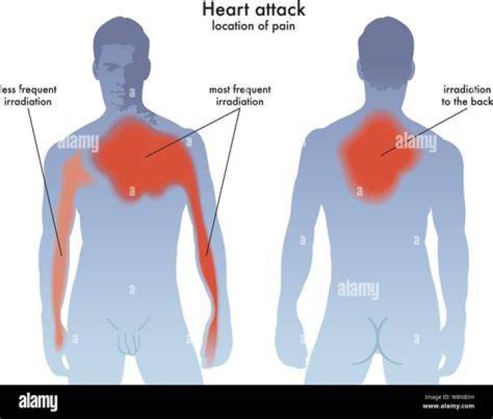 Where is heart pain located?