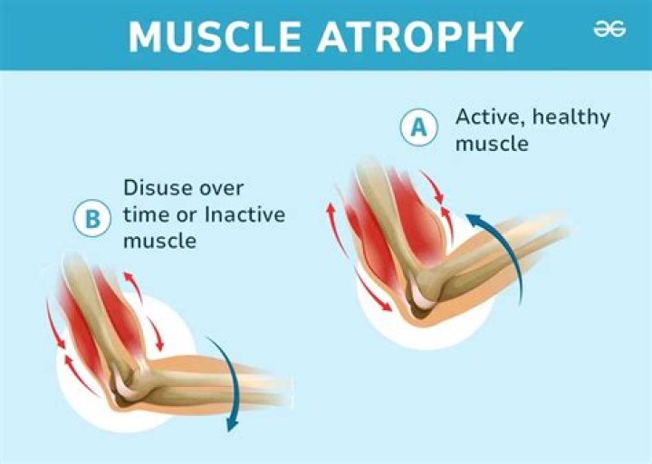 Which muscle is called the kissing muscle?