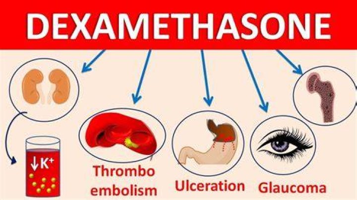 Who might benefit from dexamethasone if they have COVID-19?