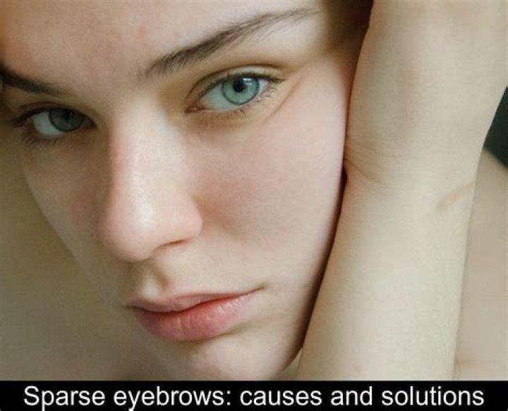 Why are my eyebrows so sparse?