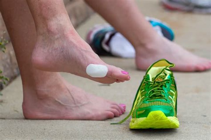 Why do I get blisters on the back of my heel from my shoes?