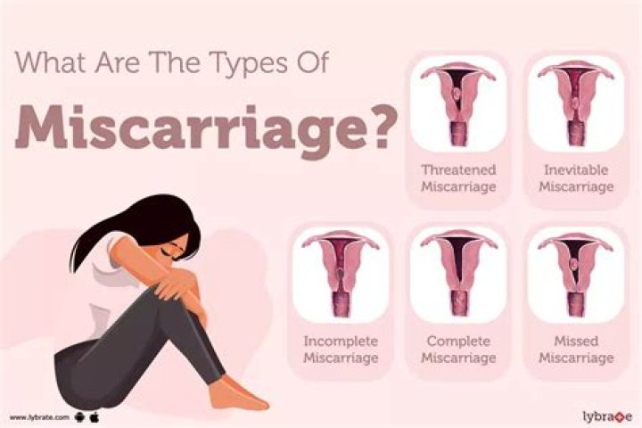 Why do I keep miscarrying at 6 weeks?