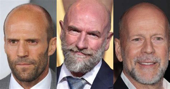 Why do I like bald guys?