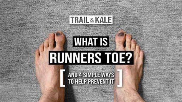 Why do runners tape their shoes?
